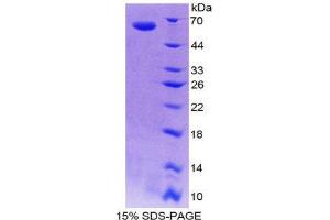 SDS-PAGE (SDS) image for Inhibin, beta E (INHBE) (AA 102-344) protein (His tag,GST tag) (ABIN2123010) (INHBE Protein (AA 102-344) (His tag,GST tag))