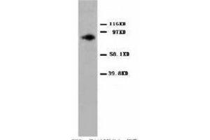 Image no. 2 for anti-Protein Kinase C, alpha (PKCa) (C-Term) antibody (ABIN1492930) (PKC alpha antibody  (C-Term))
