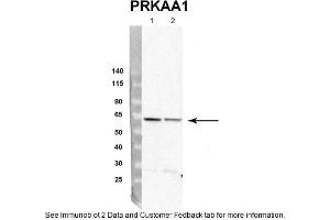 Sample Type: rat hepatocyte (50ug)Priamry Dilution: 1:4000Secondary Antibody: Donkey anti-Rabbit HRPSecondary Dilution: 1:10,000Image Submitted By: Dustin Singer,INRA/AgroParistech (PRKAA1 antibody  (Middle Region))
