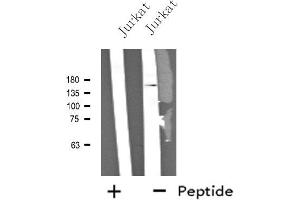 Western blot analysis of extracts from Jurkat cells, using NCAN antibody. (Neurocan antibody  (Internal Region))