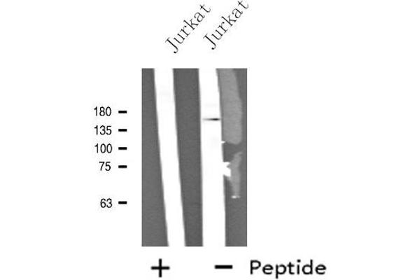 Neurocan antibody  (Internal Region)