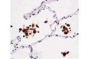 Immunohistochemical analysis of paraffin-embedded human lung using FABP4 antibody at 1:25 dilution. (FABP4 antibody)