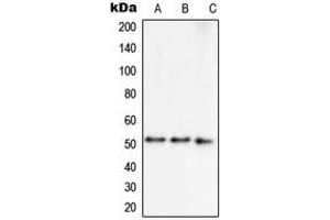 Western blot analysis of Septin 7 expression in MCF7 (A), HepG2 (B), NIH3T3 (C) whole cell lysates. (Septin 7 antibody  (C-Term))
