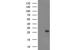 Western Blotting (WB) image for anti-Adenylate Kinase 4 (AK4) antibody (ABIN1496531) (AK4 antibody)