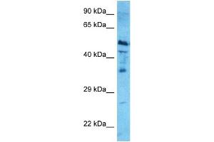 Western Blotting (WB) image for anti-Nuclear Receptor Subfamily 1, Group H, Member 4 (NR1H4) (Middle Region) antibody (ABIN2778066)