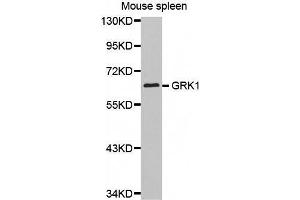 Western Blotting (WB) image for anti-G Protein-Coupled Receptor Kinase 1 (GRK1) (AA 1-160) antibody (ABIN3023688) (GRK1 antibody  (AA 1-160))
