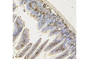 IHC analysis of COPE using anti-COPE antibody (ABIN7602509). (COPE antibody  (AA 80-308))