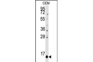 Western blot analysis of anti-PFDN6 Antibody (N-term) (ABIN389346 and ABIN2839455) in CEM cell line lysates (35 μg/lane). (PFDN6 antibody  (N-Term))