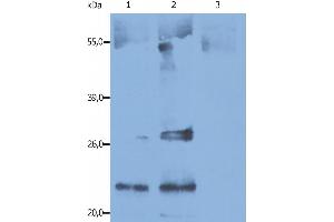 Immunoprecipitation of human CD9 from the biotin-labeled human platelets lysates. (CD9 antibody)