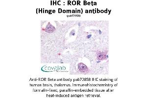 Image no. 1 for anti-RAR-Related Orphan Receptor B (RORB) antibody (ABIN1738925) (RORB antibody)
