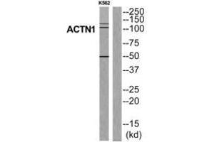 Western blot analysis of extracts from K562 cells, using ACTN1 antibody.