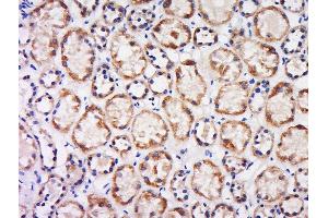 Paraformaldehyde-fixed, paraffin embedded human kidney, Antigen retrieval by boiling in sodium citrate buffer (pH6) for 15min, Block endogenous peroxidase by 3% hydrogen peroxide for 30 minutes, Blocking buffer (normal goat serum) at 37°C for 20min, Antibody incubation with Rabbit Anti-CX3CL1 Polyclonal Antibody, Unconjugated  at 1:200 overnight at 4°C, followed by a conjugated secondary and DAB staining.