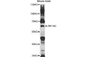 Western blot analysis of extracts of mouse brain, using ZNF582 antibody (ABIN6292528) at 1:1000 dilution. (ZNF582 antibody)