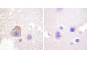 Immunohistochemical analysis of paraffin-embedded human brain tissue using ADD1 (Ab-726) antibody. (alpha Adducin antibody)