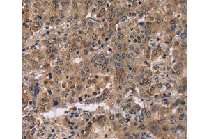 Immunohistochemistry (IHC) image for anti-Family with Sequence Similarity 107, Member A (FAM107A) antibody (ABIN2423423) (FAM107A antibody)