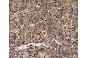 Immunohistochemistry (IHC) image for anti-Family with Sequence Similarity 107, Member A (FAM107A) antibody (ABIN2423422) (FAM107A antibody)