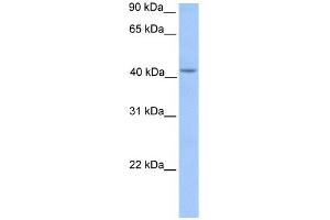 WB Suggested Anti-HMBS Antibody Titration: 0. (HMBS antibody  (Middle Region))