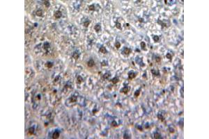 Immunohistochemistry (IHC) image for anti-V-Myb Myeloblastosis Viral Oncogene Homolog (Avian) (MYB) (AA 35-291) antibody (ABIN2118955)