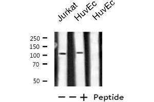 Western blot analysis of extracts from Jurkat/HuvEc cells, using PKN1/PRK1 antibody. (PKN1 antibody  (Internal Region))