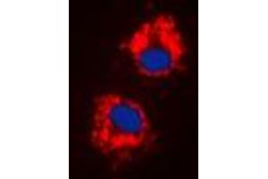 Immunofluorescent analysis of Cytochrome P450 1A1/2 staining in HeLa cells. (CYP1A1/2 antibody  (Center))