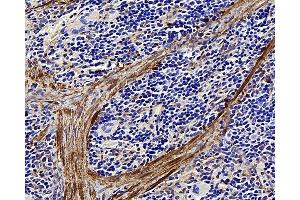 Immunohistochemistry analysis of paraffin-embedded rat spleen using LDLR Polyclonal Antibody at dilution of 1:300. (LDLR antibody)