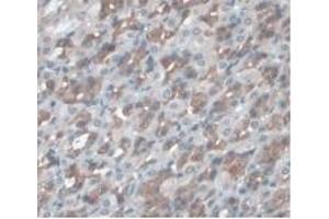 Detection of a1AGP in Rat Stomach Tissue using Monoclonal Antibody to Alpha-1-Acid Glycoprotein (a1AGP) (ORM1 antibody  (AA 20-186))
