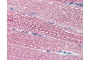 Anti-Acetylcholinesterase antibody IHC of human skeletal muscle. (Acetylcholinesterase antibody  (N-Term))