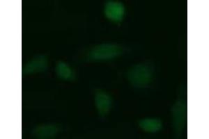 Immunofluorescent staining of HeLa cells with GLB1 monoclonal antibody, clone 10B2 . (GLB1 antibody)