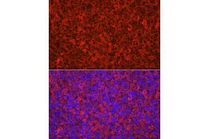 Immunofluorescence analysis of rat adrenal gland using CYP11 Rabbit pAb (713) at dilution of 1:100 (40x lens).