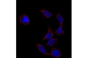 Immunofluorescence analysis of POU5F1 polyclonal antibody  in HeLa cells. (OCT4 antibody  (Glu125))