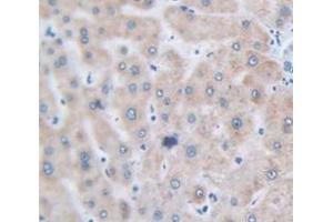 IHC-P analysis of Human Tissue, with DAB staining. (FGF2 antibody  (AA 159-288))
