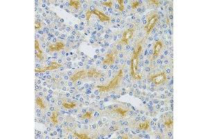 Immunohistochemistry of paraffin-embedded rat kidney using UBE2B Antibody. (UBE2B antibody  (AA 1-152))