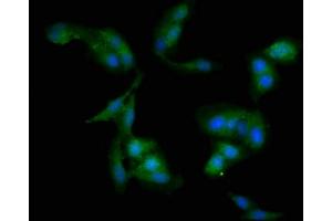 Immunofluorescent analysis of Hela cells using ABIN7175699 at dilution of 1:100 and Alexa Fluor 488-congugated AffiniPure Goat Anti-Rabbit IgG(H+L) (WDFY3 antibody  (AA 1-100))