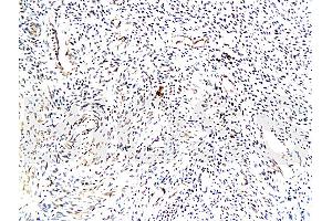 Formalin-fixed and paraffin embedded: human endometrium Anti-TrK-A/NTRK1 Polyclonal Antibody (ABIN726110), Unconjugated at 1:200 followed by conjugation to the secondary antibody and DAB staining (TRKA antibody  (AA 725-821))