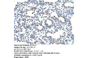Human Lung (ZNF265 antibody  (Middle Region))