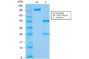 SDS-PAGE Analysis of Purified BCL2 Mouse Recombinant Monoclonal Antibody ABIN6383839. (Recombinant Bcl-2 antibody)