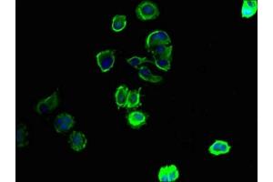 Immunofluorescent analysis of MCF-7 cells using ABIN7170255 at dilution of 1:100 and Alexa Fluor 488-congugated AffiniPure Goat Anti-Rabbit IgG(H+L) (SLC43A3 antibody  (AA 209-278))
