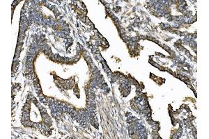 IHC analysis of KIF2A using anti-KIF2A antibody (ABIN7600510). (KIF2A antibody  (AA 2-706))