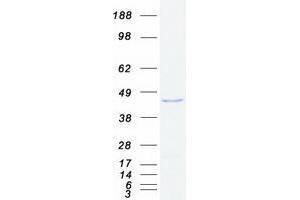 Validation with Western Blot