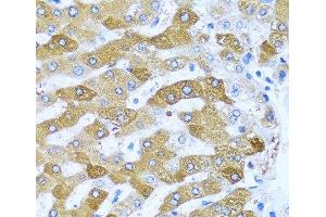 Immunohistochemistry of paraffin-embedded Human liver using IFIT3 Polyclonal Antibody at dilution of 1:100 (40x lens). (IFIT3 antibody)
