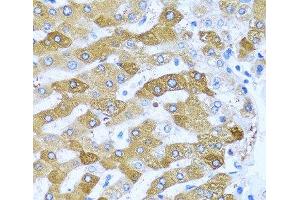 Immunohistochemistry of paraffin-embedded Human liver using IFIT3 Polyclonal Antibody at dilution of 1:100 (40x lens).