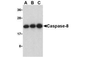 Western blot analysis of caspase-8 in Jurkat cell lysate with AP30203PU-N caspase-8 antibody at (A) 0. (Caspase 8 antibody  (C-Term))