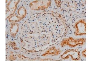 ABIN6267400 at 1/200 staining Human kidney tissue sections by IHC-P. (CREB1 antibody  (pSer133))