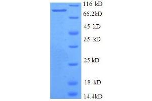 SDS-PAGE (SDS) image for IMP (Inosine 5'-Monophosphate) Dehydrogenase 2 (IMPDH2) (AA 5-514), (partial) protein (GST tag) (ABIN7479597)