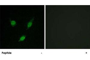 Immunofluorescence analysis of MCF-7 cells, using TACC1 polyclonal antibody . (TACC1 antibody  (N-Term))