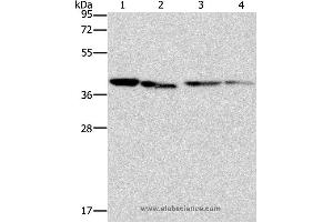 Western blot analysis of Human placenta tissue and NIH/3T3 cell, Raji and hepG2 cell, using BCAT2 Polyclonal Antibody at dilution of 1:312. (BCAT2 antibody)