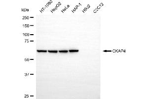 Western blotting analysis using CKAP4 antibody (ABIN7798267).