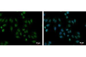 ICC/IF Image PABPN1 antibody detects PABPN1 protein at cytoplasm and nucleus by immunofluorescent analysis. (PABPN1 antibody)