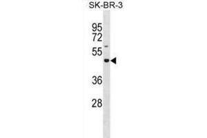 Western Blotting (WB) image for anti-Glucoside Xylosyltransferase 2 (GXYLT2) antibody (ABIN3001024) (GXYLT2 antibody)