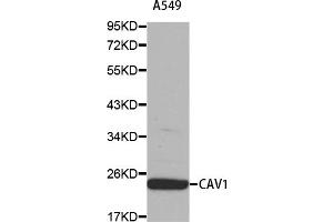 Western blot analysis of extracts of A-549 cells, using CAV1 antibody (ABIN5969989). (Caveolin-1 antibody)